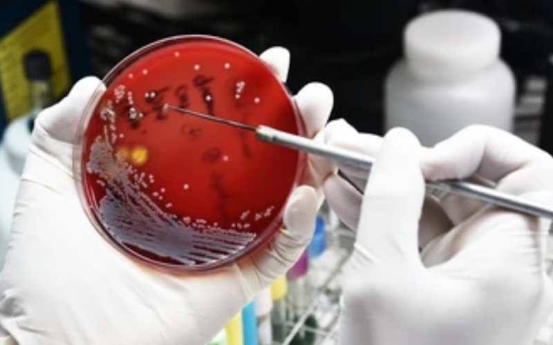 Antibiotic resistance the second, silent pandemic