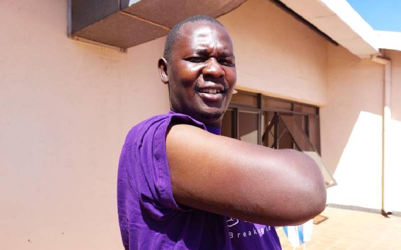 Study: There are two millions Kenyans living with epilepsy