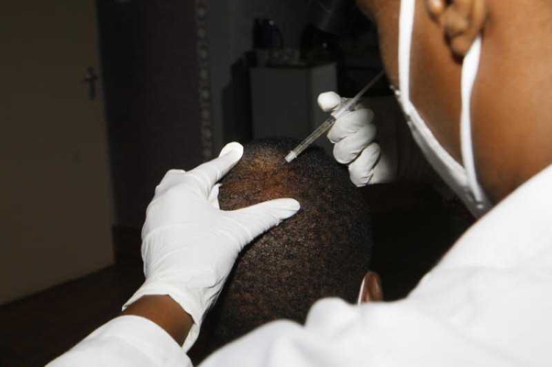 Balding? you can regain your hair … at a cost