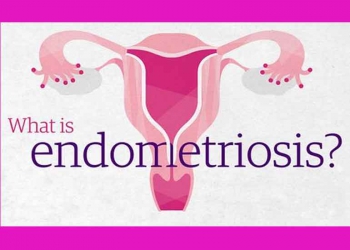 Get to know Endometriosis a little better 