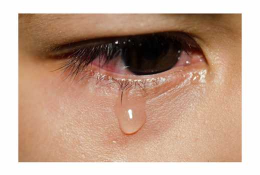 Seven reasons you have dry and irritated eyes