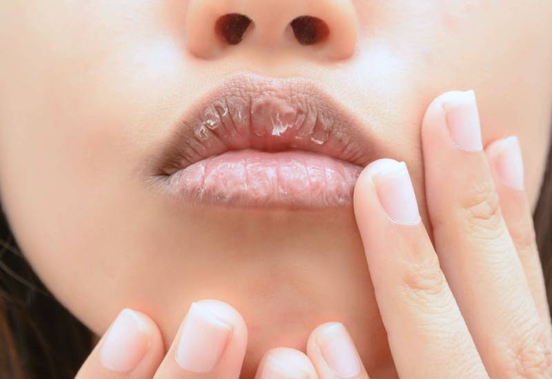 Peretasan mudah untuk membantu mencegah bibir pecah-pecah Wanita Hawa