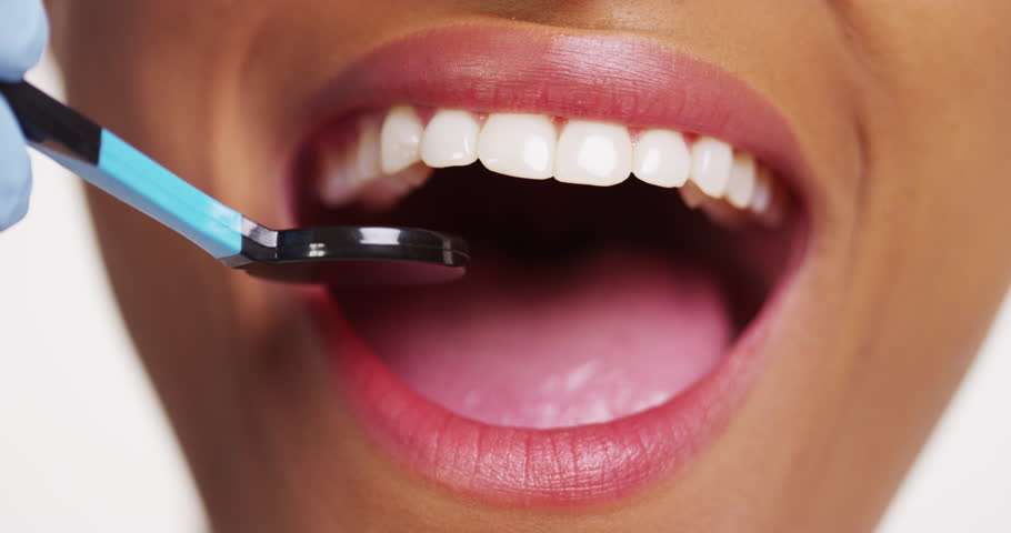 Five teeth whitening tips you can hack at home