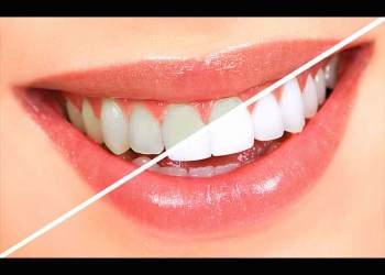 Eight cheap ways to whiten teeth at home: Celebrity doctor reveals his homemade secrets to a brighter smile