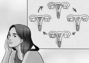 Yes, you can get pregnant with an irregular period