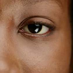 9 surprising things your eyes could say about your health
