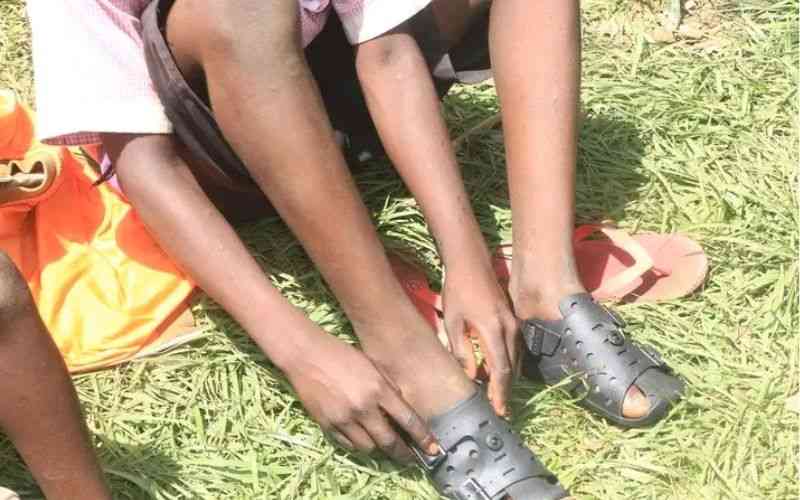 Anti-jigger campaign gives hope to school children in Busia