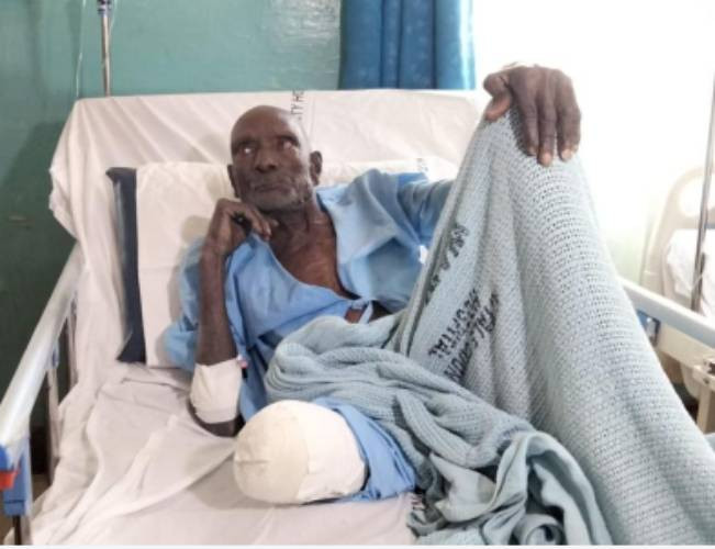 Deserted grandpa, 86, appeals for medical, food aid after his leg was amputated