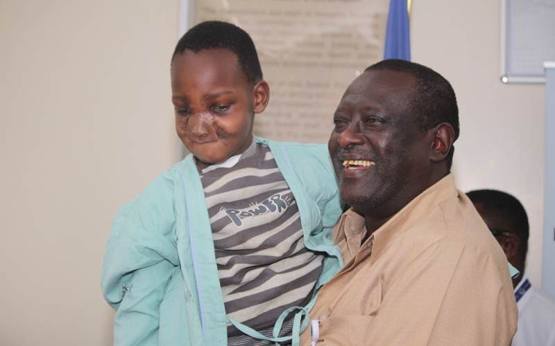 KNH unveils reconstructed face of boy after groundbreaking surgery