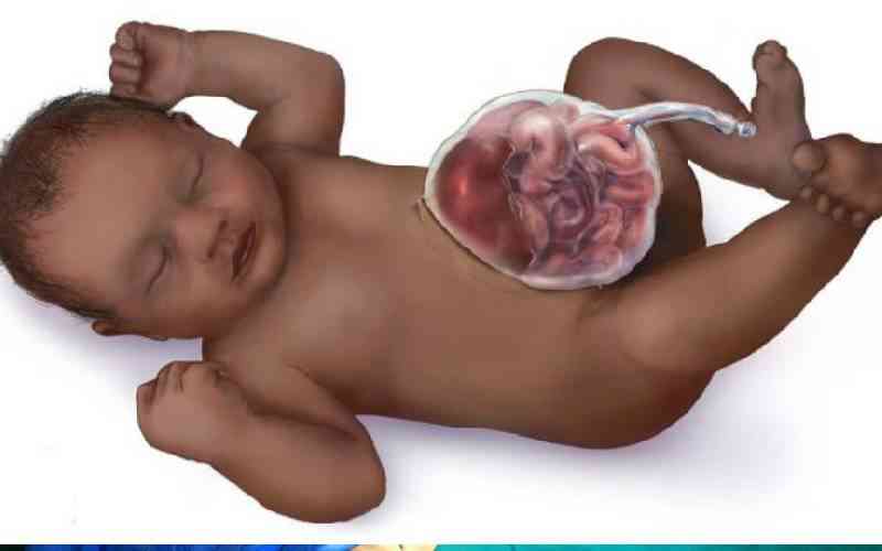 Born different: The silent crisis of birth defects, stigma and toll