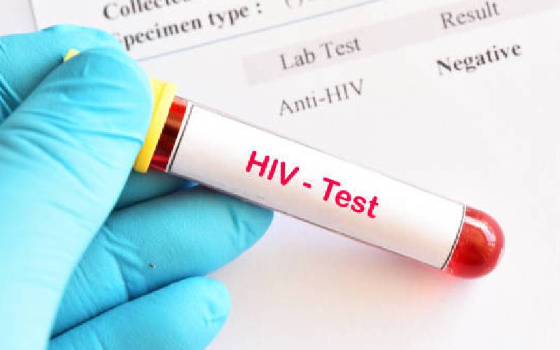 Kenya on track in war on HIV despite setbacks