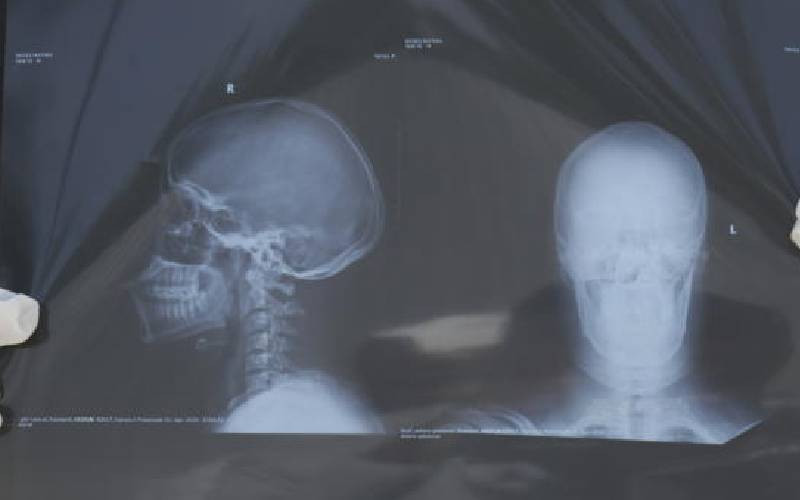 No life without a brain, surgeon cautions