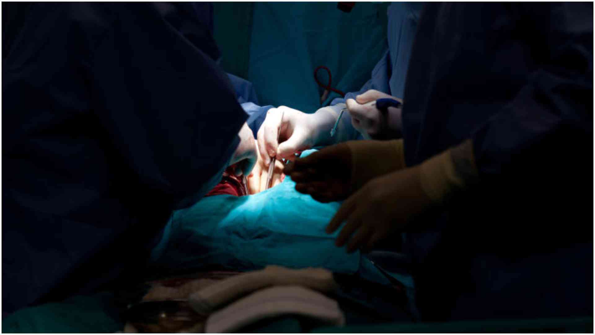 Woman dies after 'drunk quack' allegedly performs surgery using YouTube tutorial