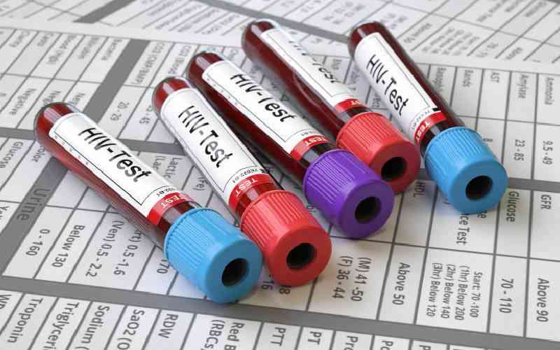 Health Ministry set to roll out new HIV testing model in July