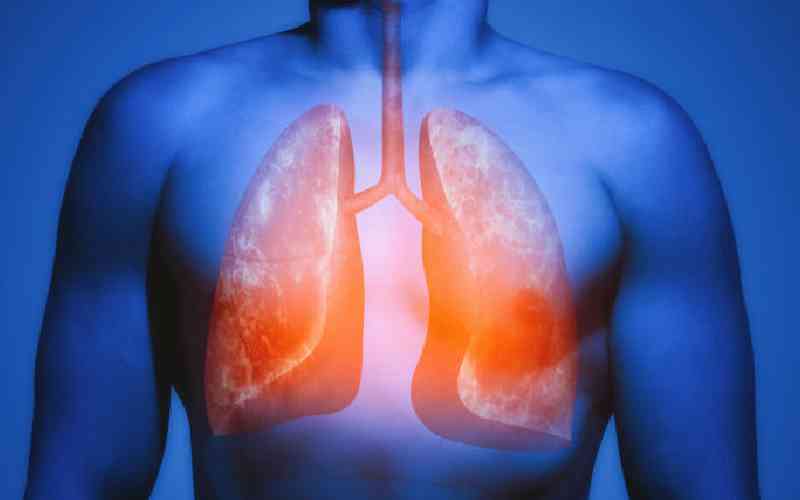 A closer look at Tuberculosis,...