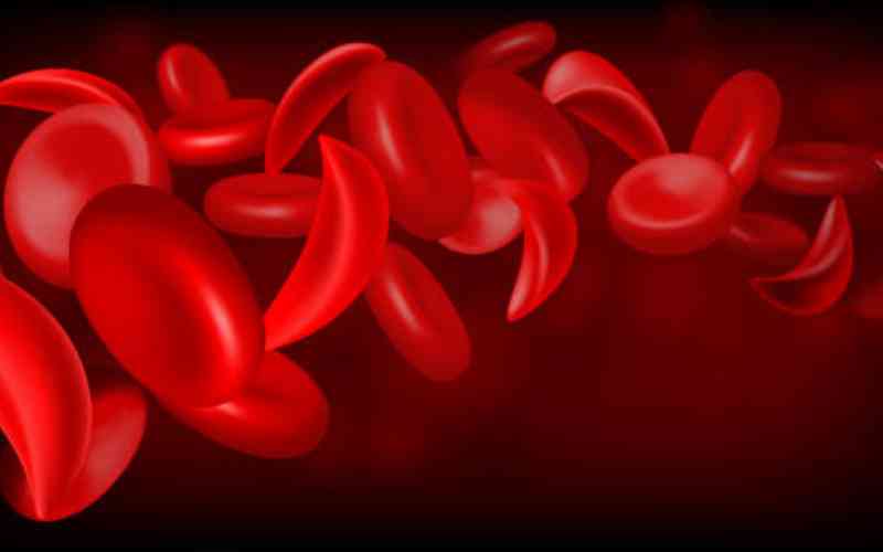 Sickle cell warriors call for mandatory screening to curb rising cases in Western