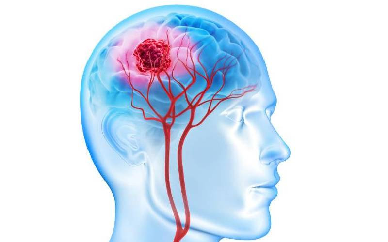 Wambua's fight with brain tumor, blurry vision and Sh2.5m bill
