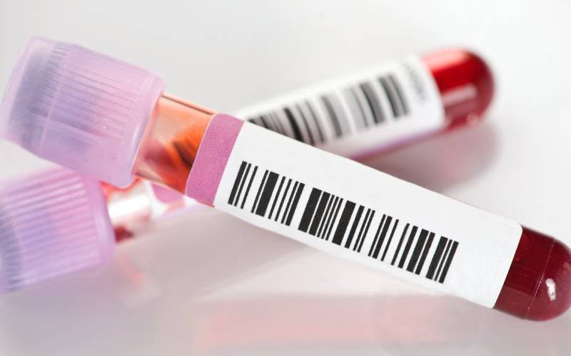 Norwegian effectively cured of HIV after transplant from brother