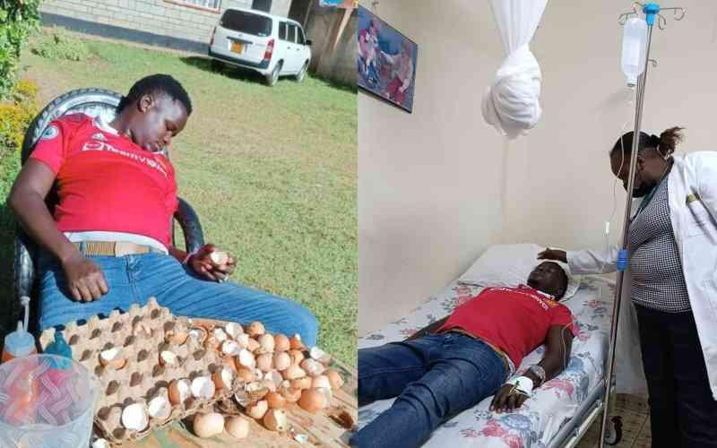 Eldoret Man United fan hospitalised after eating 15 eggs