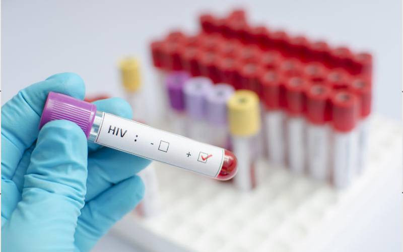 Ministry to roll out new HIV testing strategy next month