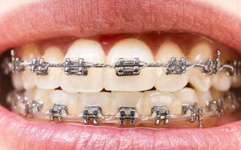 Kenya needs more dentists, personal attention to improve oral hygiene