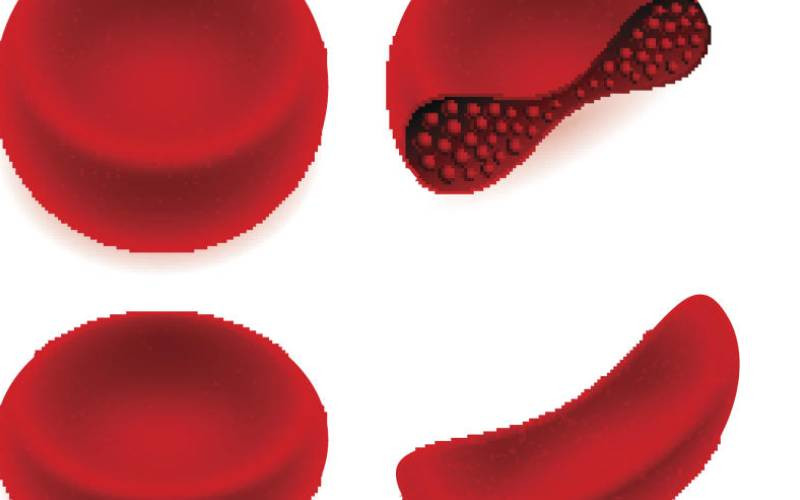 War on sickle cell disease hindered by stigma, budget cuts