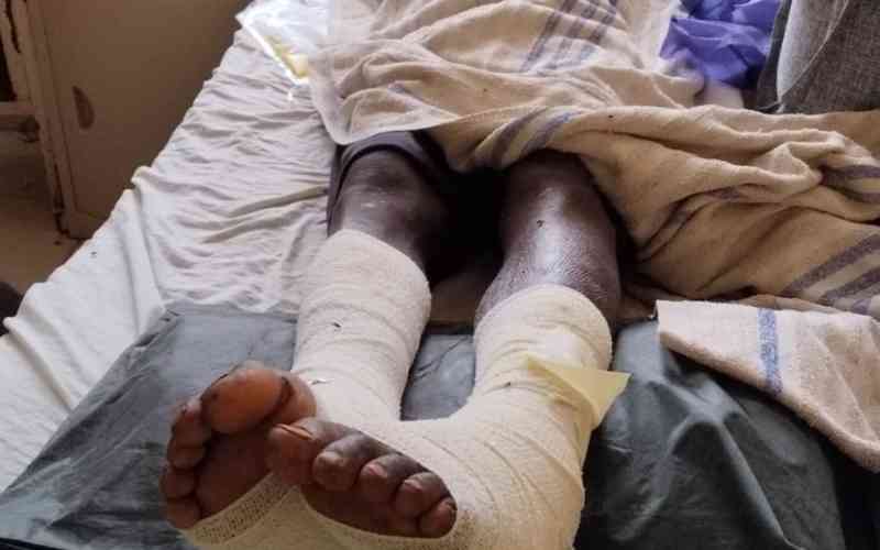 Minor fights for life after alleged torture in police cell