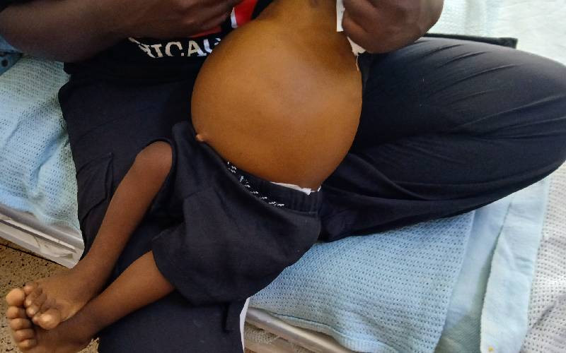 A mother's sacrifice, Sh6m cost for a liver, the battle they ultimately lost