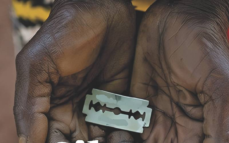 Cut against their will: How FGM leaves lasting scars on girls, women