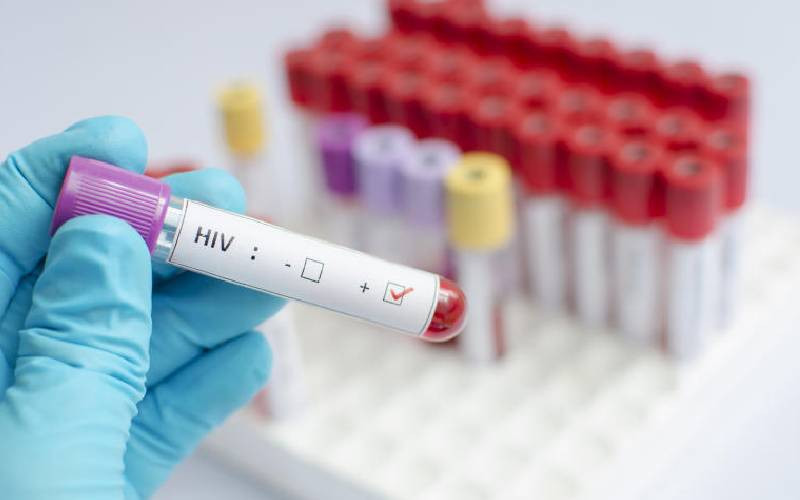 HIV kits donation saga brews as ministry, manufacturer differ