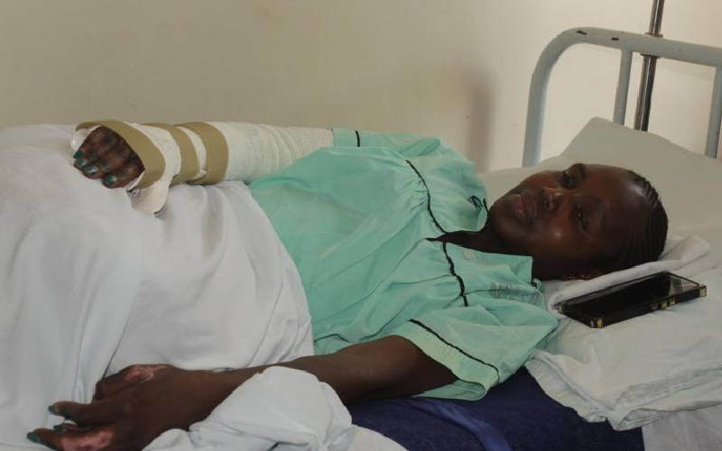Woman demands justice after suffering burns in scuffle between hawkers and county askaris