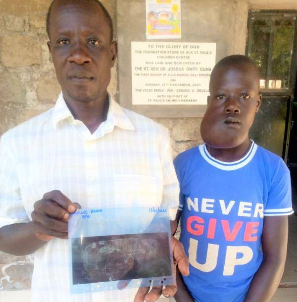 Help me get my son surgery for rare tumor- Busia father