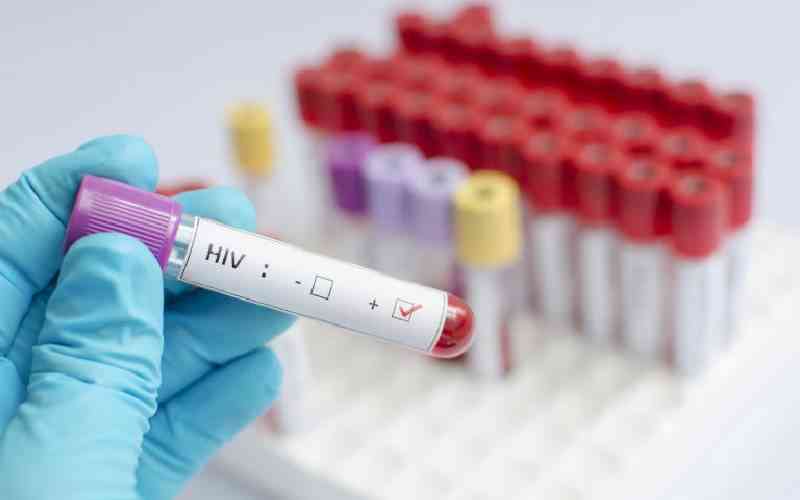 Pathologist accuses Health Ministry of exposing Kenyans to danger in HIV kits case