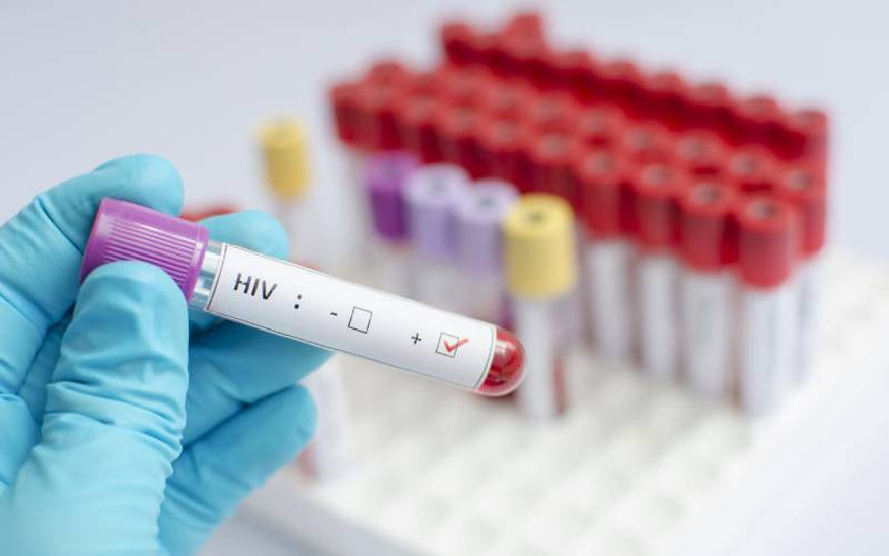 Why the youth prefer oral HIV testing method