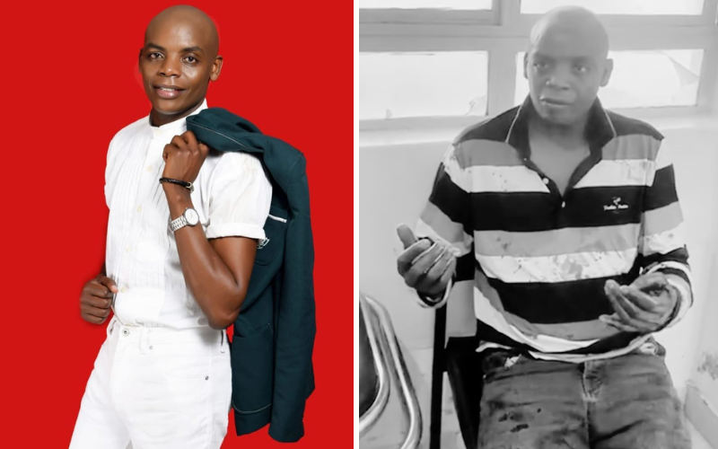 Jimmy Gait nursing injuries after brutal attack by robbers