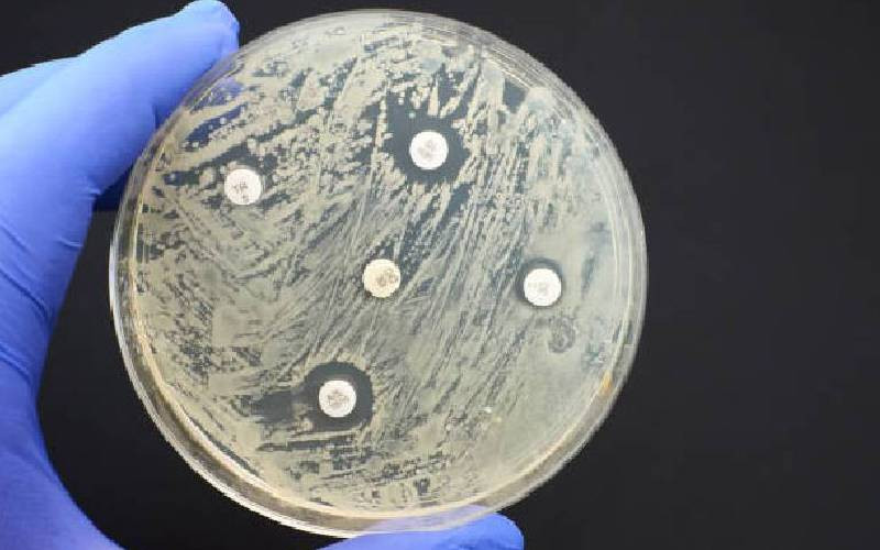 Let's beware of rising anti-microbial resistance