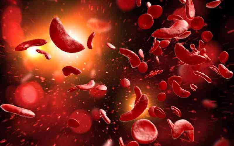 Kenya joins Africa's push to bring sickle cell care under health insurance