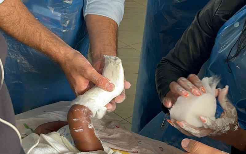 The hidden burden behind Kenya's 2,000 clubfoot births