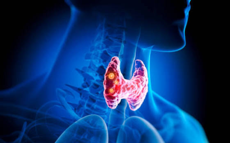 Why your thyroid may be behind unexplained weight changes
