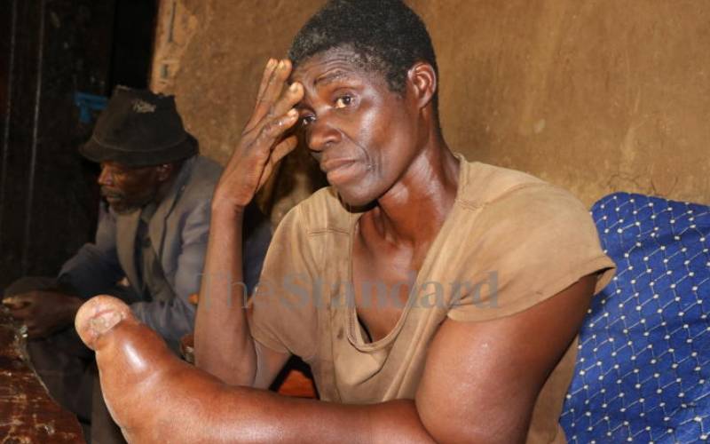 Woman defies deformity to look after her family