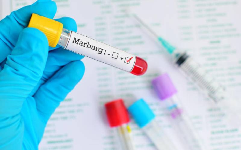 Kenya on high alert as Marburg virus cases increase in Rwanda