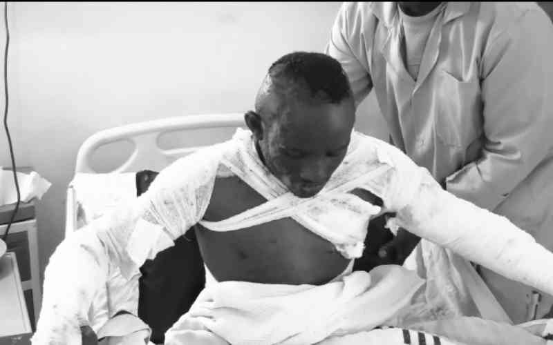 Mob beats and sets suspected theft on fire