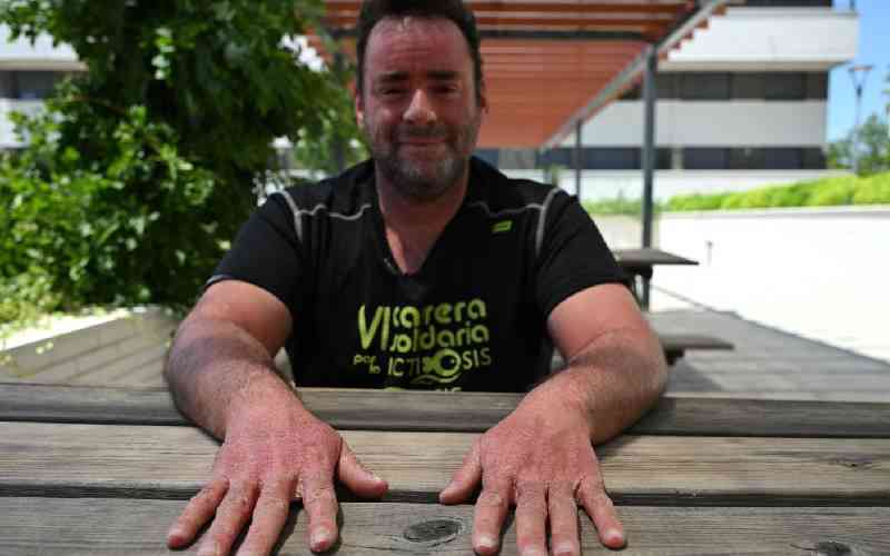 Spaniard's rare skin disorder ups danger of summer heat