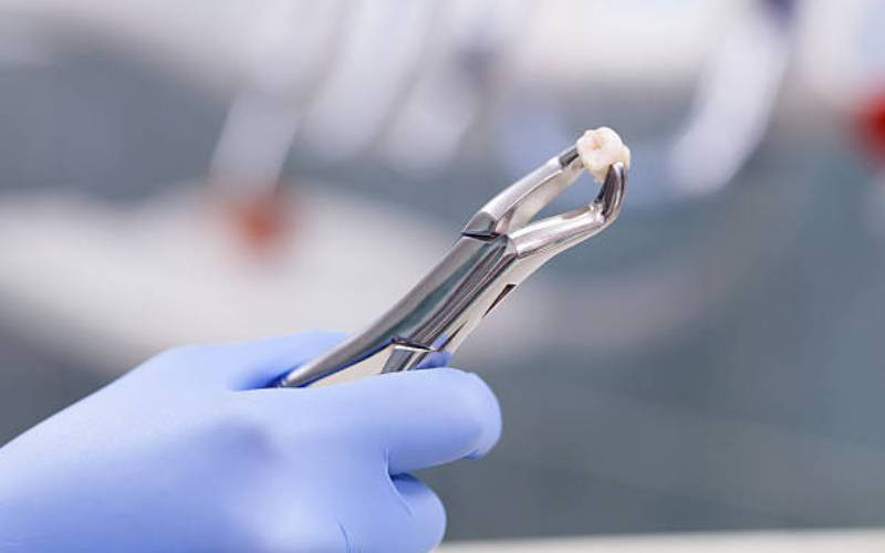 Why tooth extraction should be a last resort