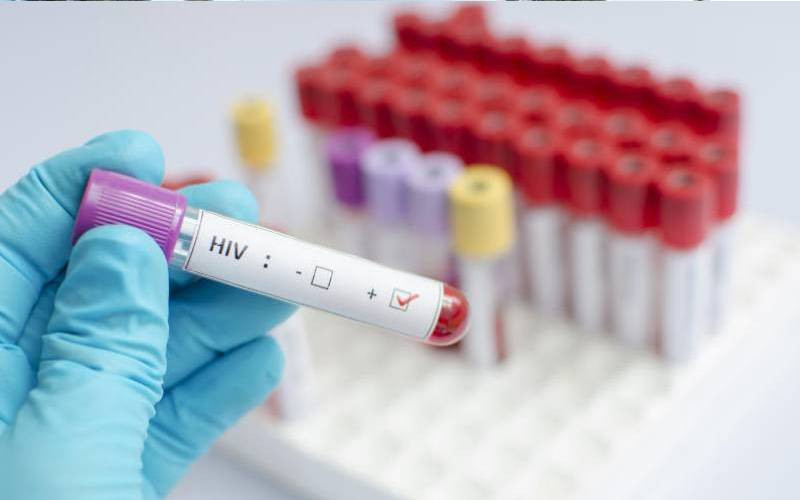 Kenya moves to stabilise HIV, TB services after funding shock