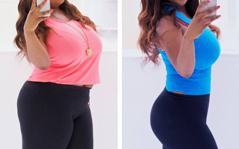 Ozempic craze: Quick fix or long-term fixation?
