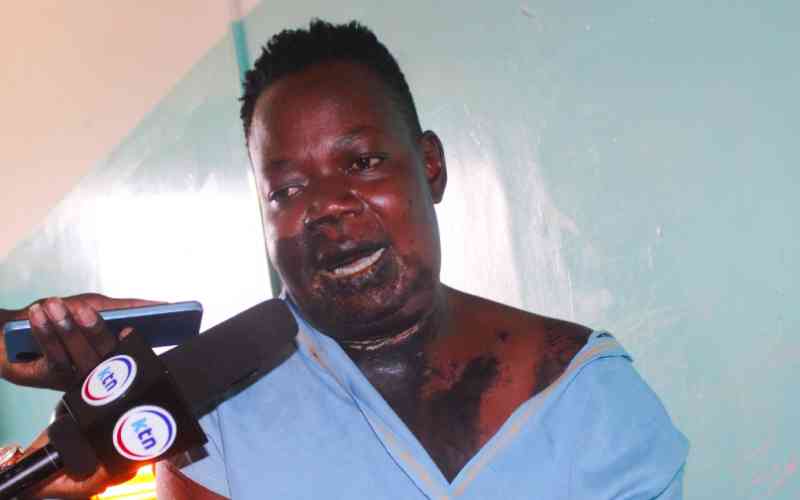 From friends to foes: Woman in Kisumu acid attack says best friend to blame