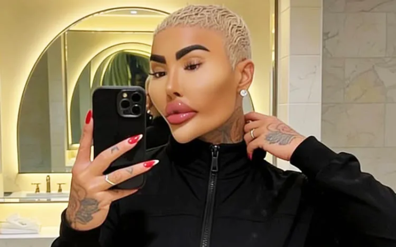 'Botched' star and self-proclaimed 'Lip King' Jordan James dies at 34