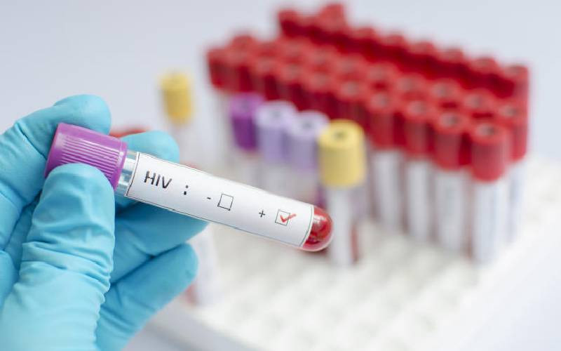 Controversy over procurement of HIV testing kits
