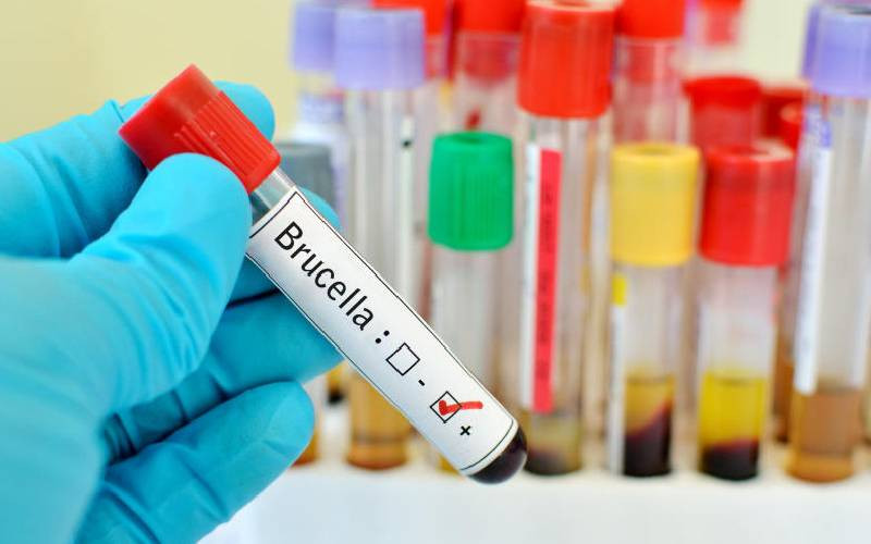 How raw milk and red meat drive brucellosis transmission in humans